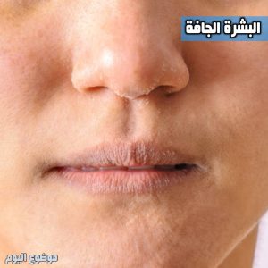 كيف اعرف نوع بشرتي البشرة الجافة 